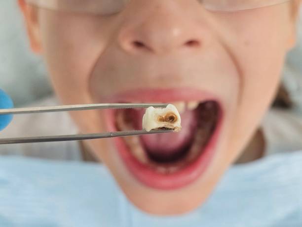 Best Emergency Orthodontic Services in Roanoke, IN